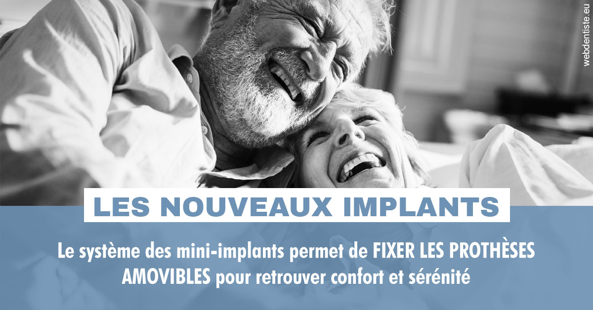 https://www.drs-mamou.fr/Les nouveaux implants 2