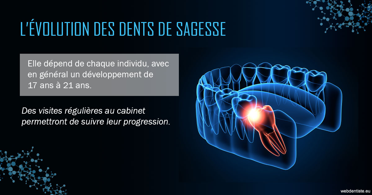 https://www.drs-mamou.fr/2023 T4 - Dents de sagesse 01