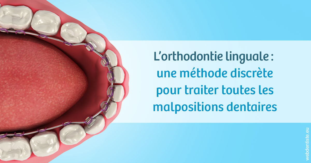 https://www.drs-mamou.fr/L'orthodontie linguale 1