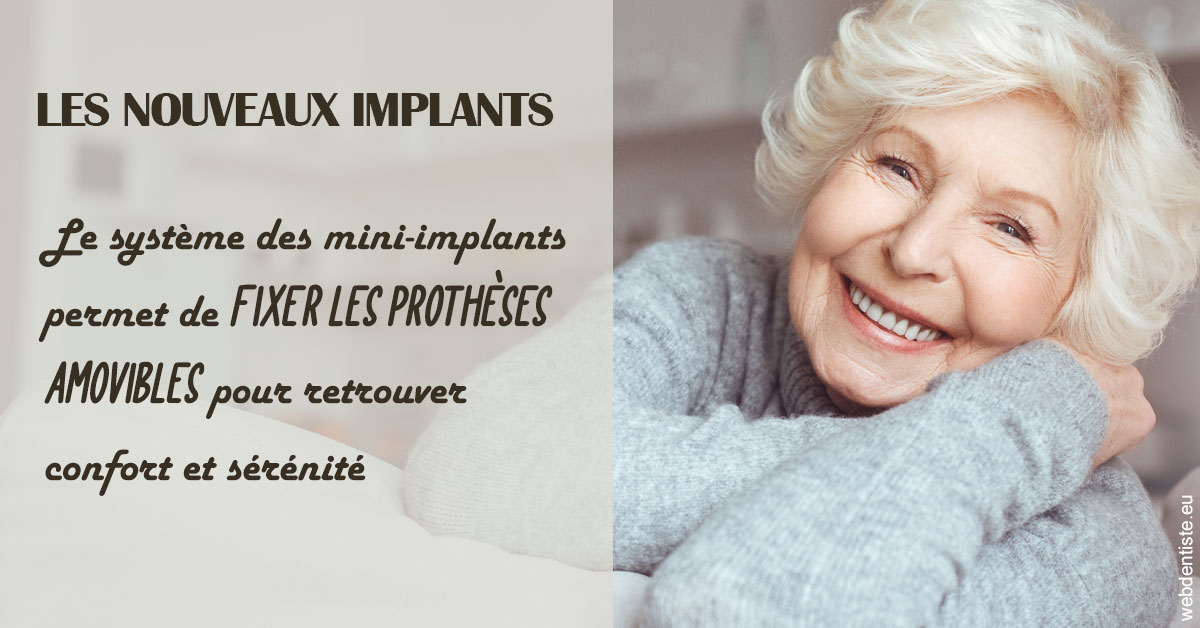 https://www.drs-mamou.fr/Les nouveaux implants 1
