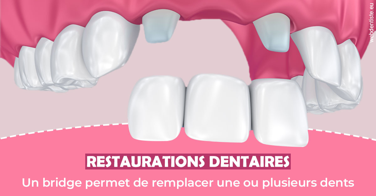 https://www.drs-mamou.fr/Bridge remplacer dents 2
