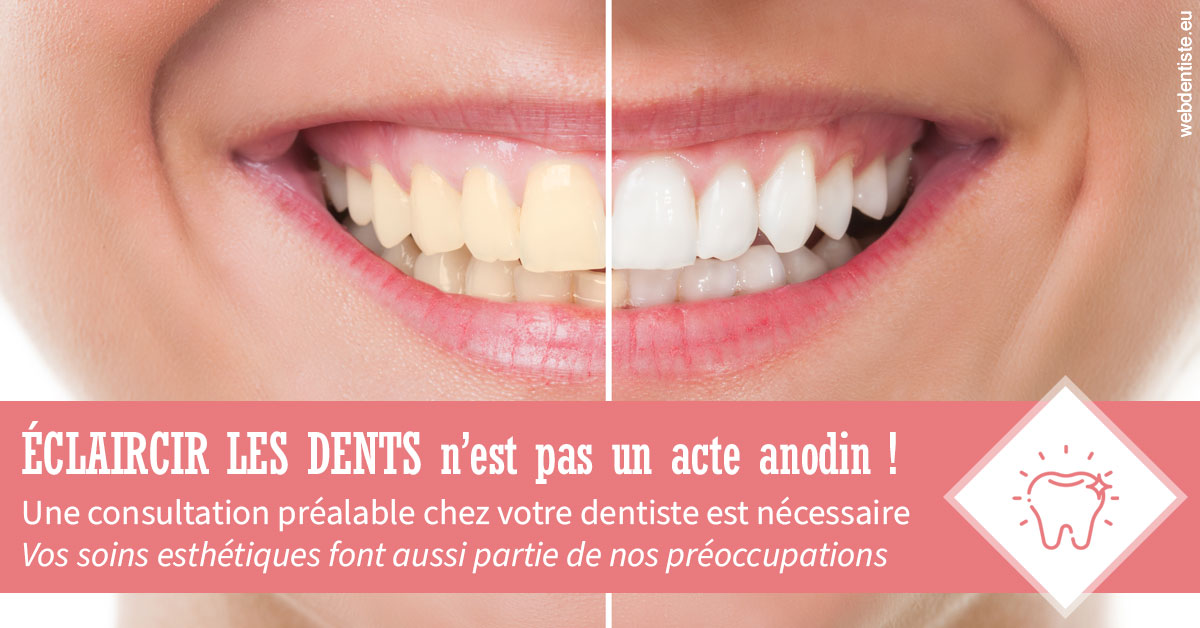 https://www.drs-mamou.fr/Eclaircir les dents 1