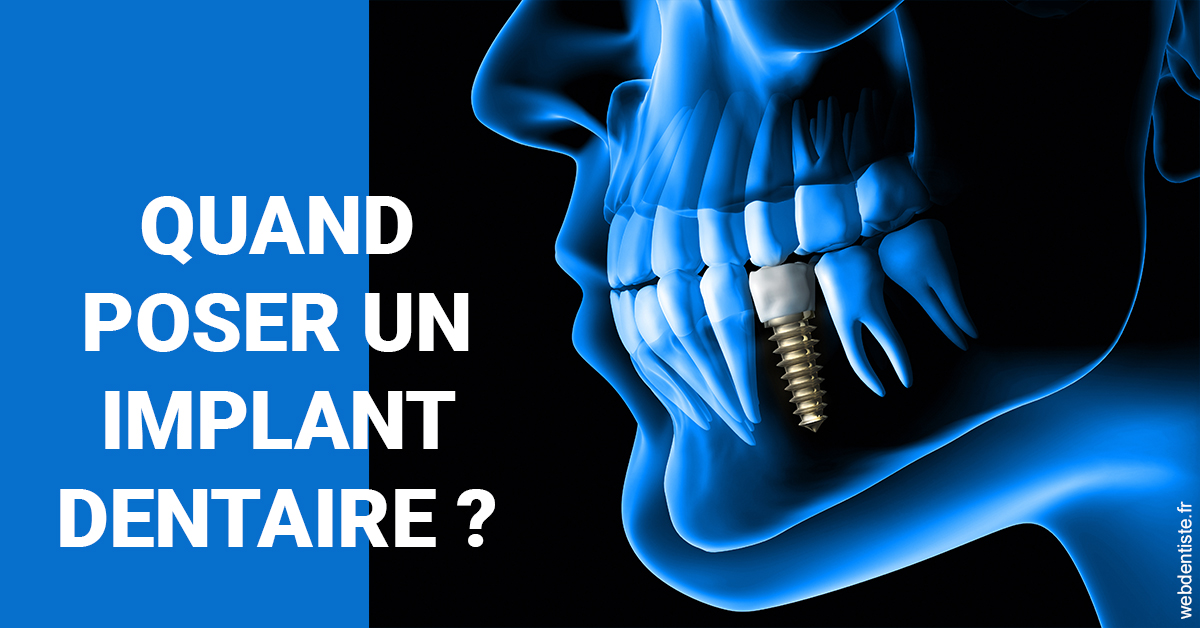 https://www.drs-mamou.fr/Les implants 1