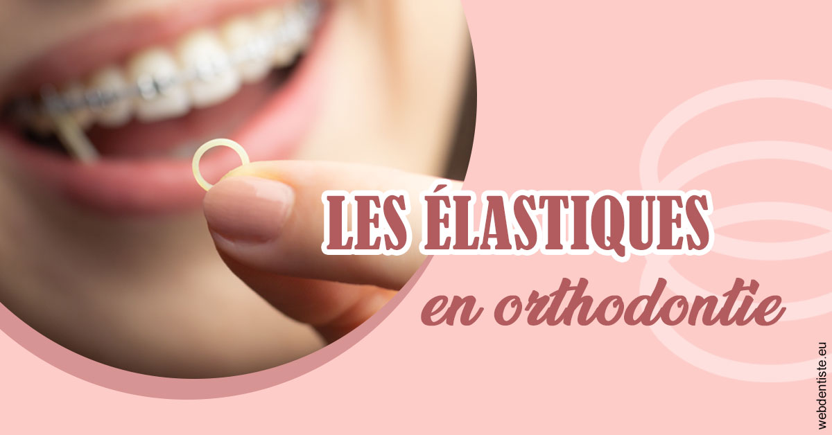 https://www.drs-mamou.fr/Elastiques orthodontie 1