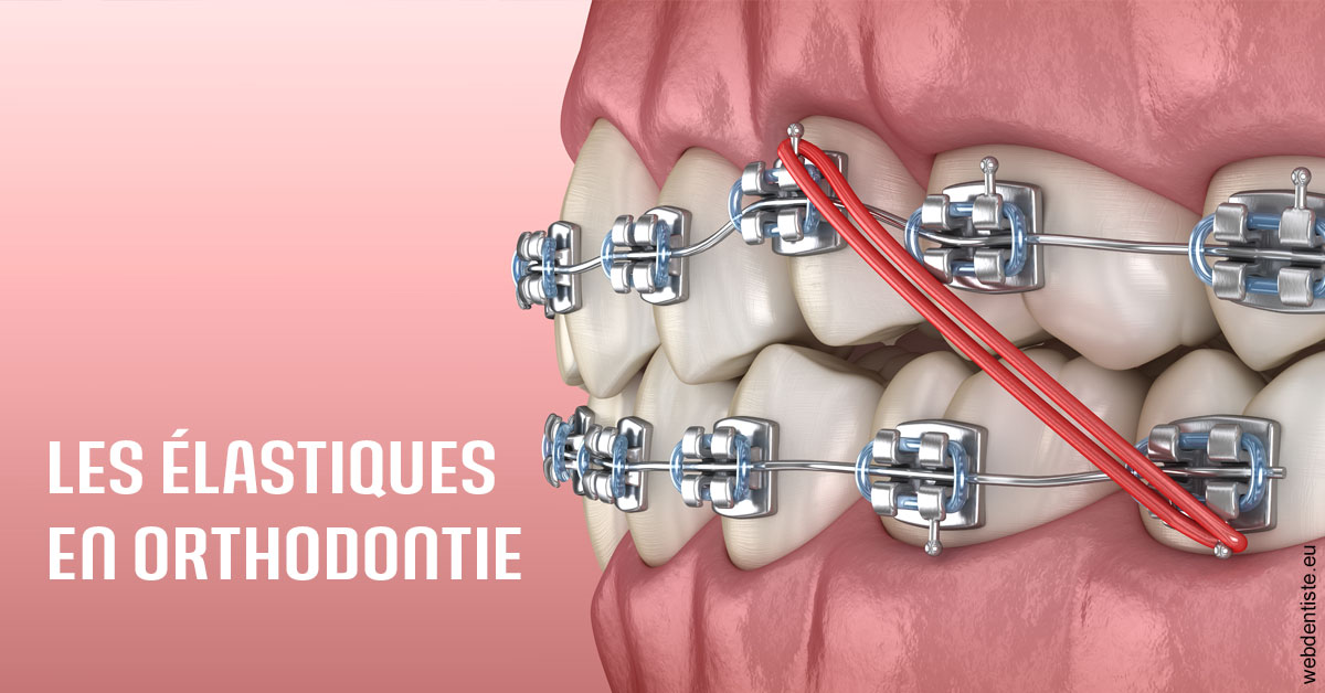https://www.drs-mamou.fr/Elastiques orthodontie 2