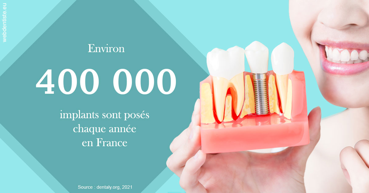 https://www.drs-mamou.fr/Pose d'implants en France 2