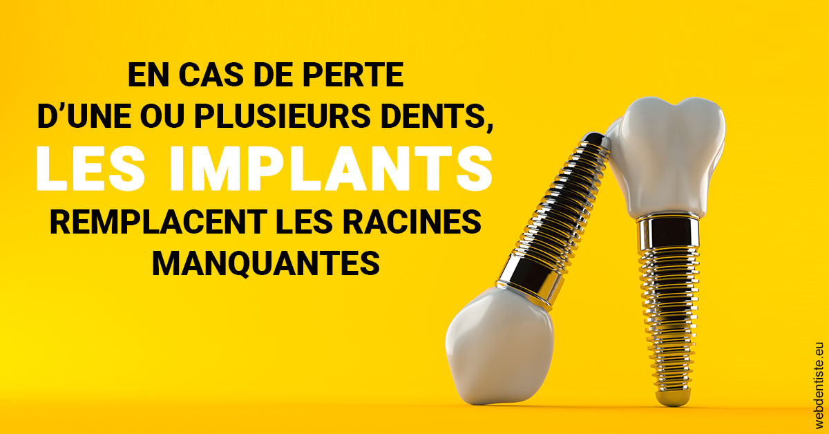 https://www.drs-mamou.fr/Les implants 2