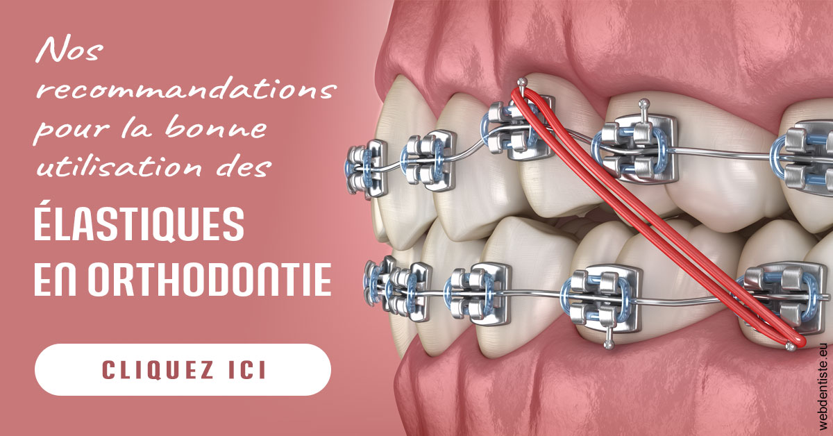 https://www.drs-mamou.fr/Elastiques orthodontie 2